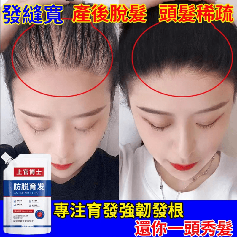 上官博士防脫育發洗發水 火爆熱銷中！台灣本土出貨！24小時在線客服，售後無憂！現在下單享受在線支付立減活動！