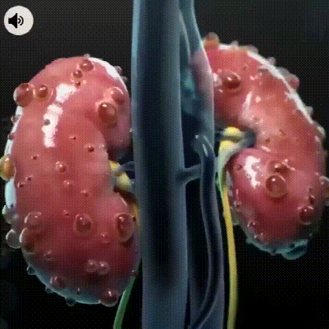 1702642042751518.gif 1.gif