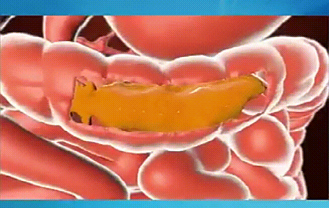 1713508346318627.gif 2.gif