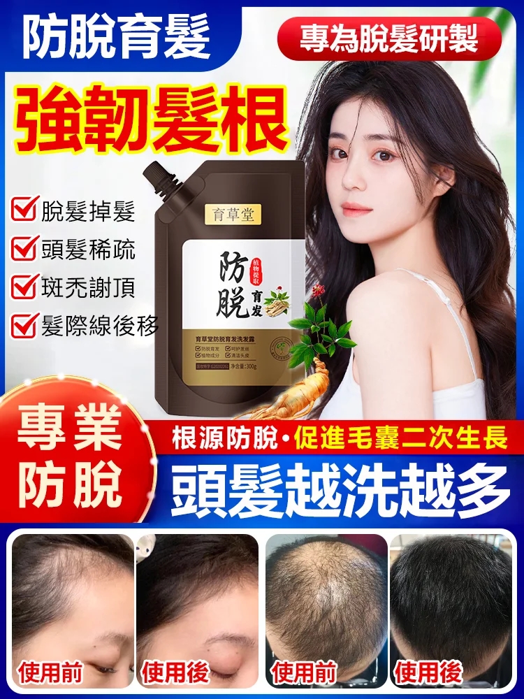 【育草堂防脫育發洗髮露】效果出類拔萃，眾多護髮品中的佼佼者。養髮，護髮，祛除頭皮上的角質，油脂，污垢。